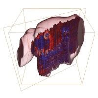 Figure B