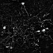 Mouse Neurons