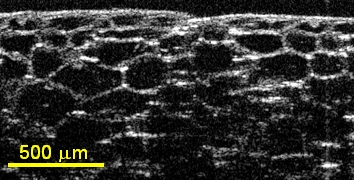 Onion Skin from 200 nm LS2000B