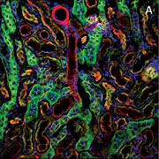 Multiphon Kidney Image