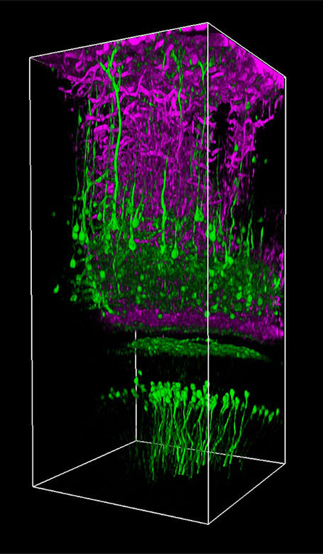 3P Image