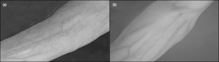Low-Magnification Objective