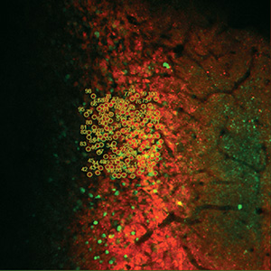 Simultaneous Photostimulation of 100 Cells Co-Expressing GCaMP6f (Green) and C1V1 (Red).