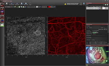 OCT Speckle Variance Imaging Screen Shot