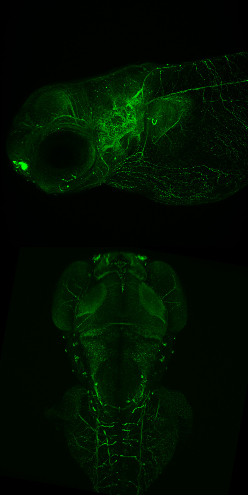 Dorsal and lateral maximum intensity projections of zebrafish embryos, 48 h post fertilization, showing developing neurons. (Courtesy of Aminah Giousoh and Dr. Robert Bryson-Richardson, School of Biological Sciences, Monash University, Victoria, Australia.)