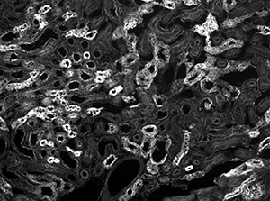 Fluorescence Image of Two Camera Overlay