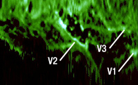 Double-Clad Coupler Fluoresence Image
