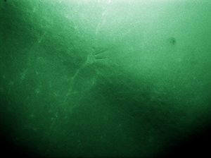 Microaspiration Image using Two Cameras
