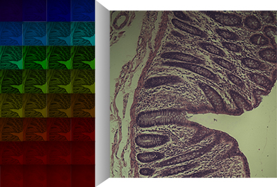 Hyperspectral Imaging of Tissue samples